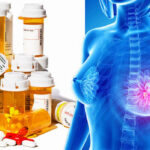 Can Medications Cause Breast Cancer