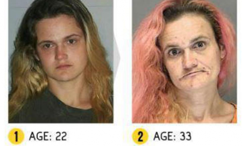 Drug Abuse Before and After Photos 2