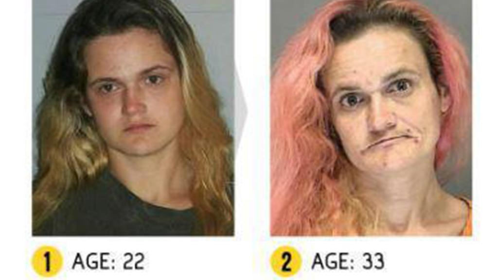 Drug Abuse Before and After Photos 2