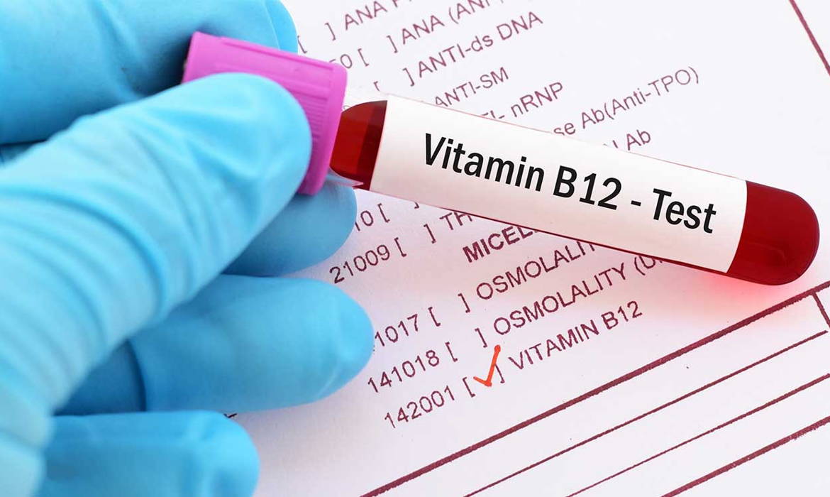 B12 deficiency