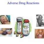 Types Of Adverse Drug Reaction (ADR)