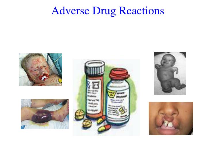 types-of-adverse-drug-reaction-adr-meds-safety