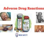 What Are The 5 Types Of Adverse Drug Reactions (ADRs)
