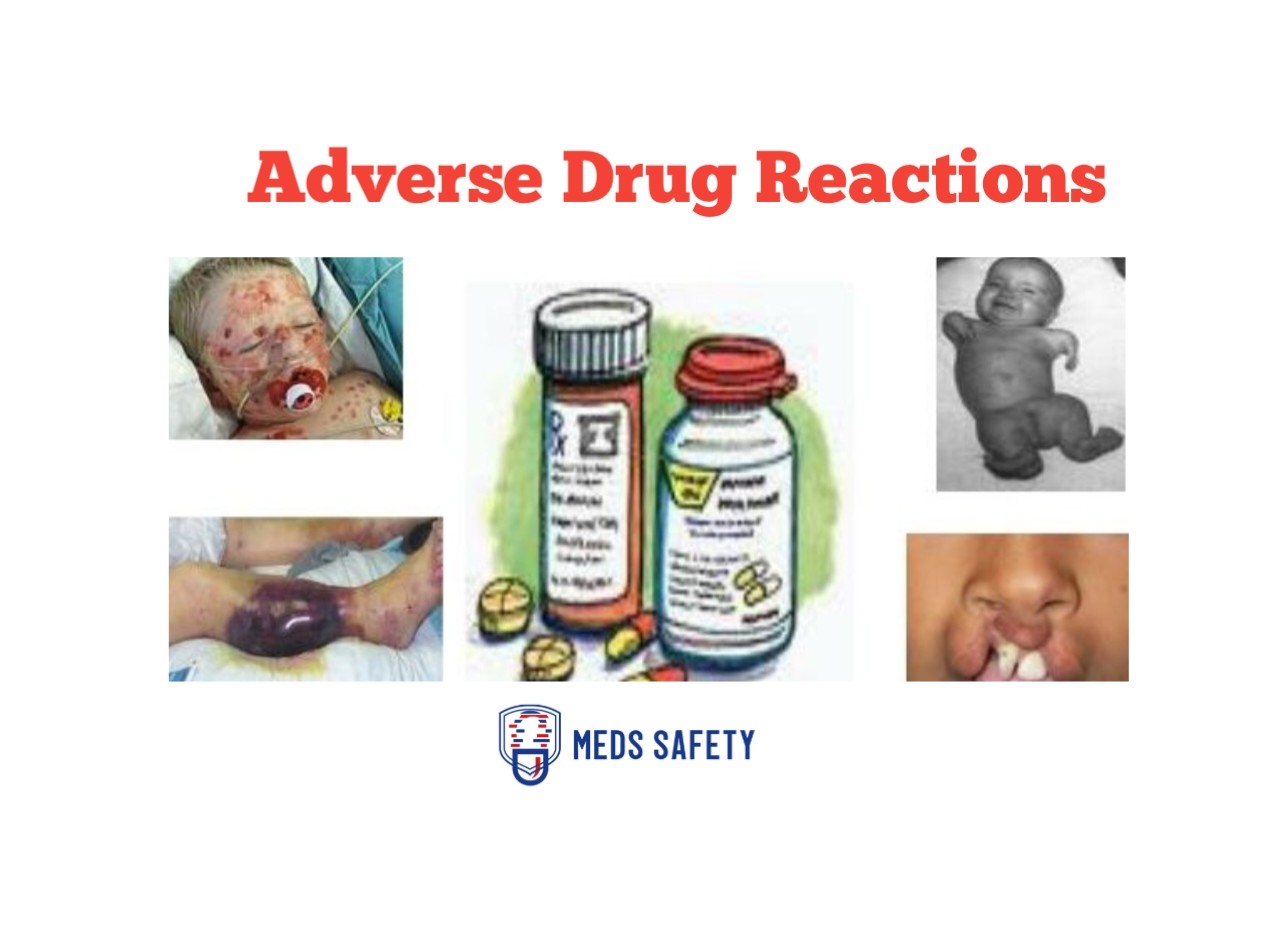 What Are The 5 Types Of Adverse Drug Reactions (ADRs)