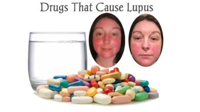 38 drugs that cause drug induced lupus
