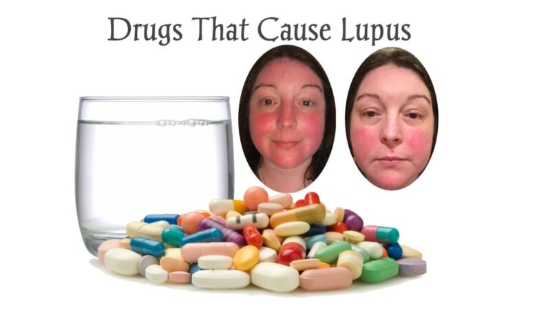 38 Drugs That Cause Drug-Induced Lupus