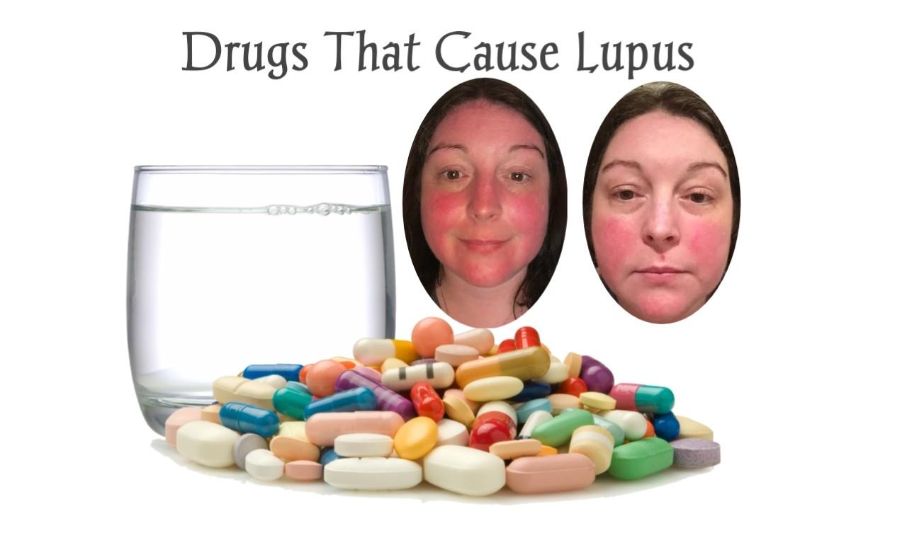 what-are-the-38-drugs-that-cause-drug-induced-lupus-meds-safety