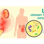 Does Metronidazole Treat Urinary Tract Infection UTI