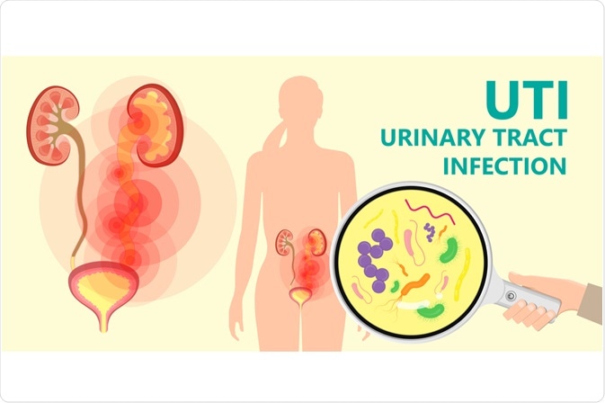 Does Metronidazole Treat Urinary Tract Infection (UTI)