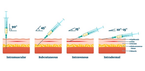 Giving Subcutaneous Injection Intramuscularly