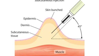 What Gives Faster Effects, IM, IV, or Subcutaneous Injection? - Meds Safety