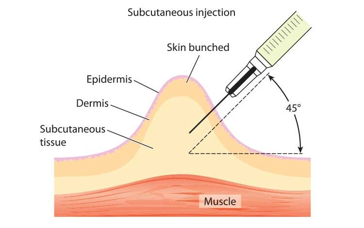 Why Are Subcutaneous Injections Given At A 45-Degree Angle