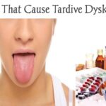 50 drugs that cause tardive dyskinesia