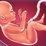 Drug abuse in Pregnancy and Effect on the Newborn
