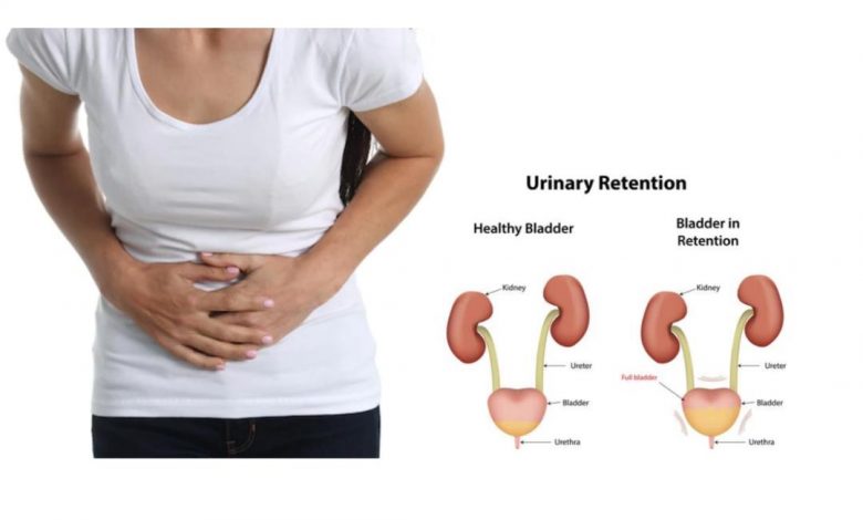 What Drugs Can Cause Urinary Retention 1