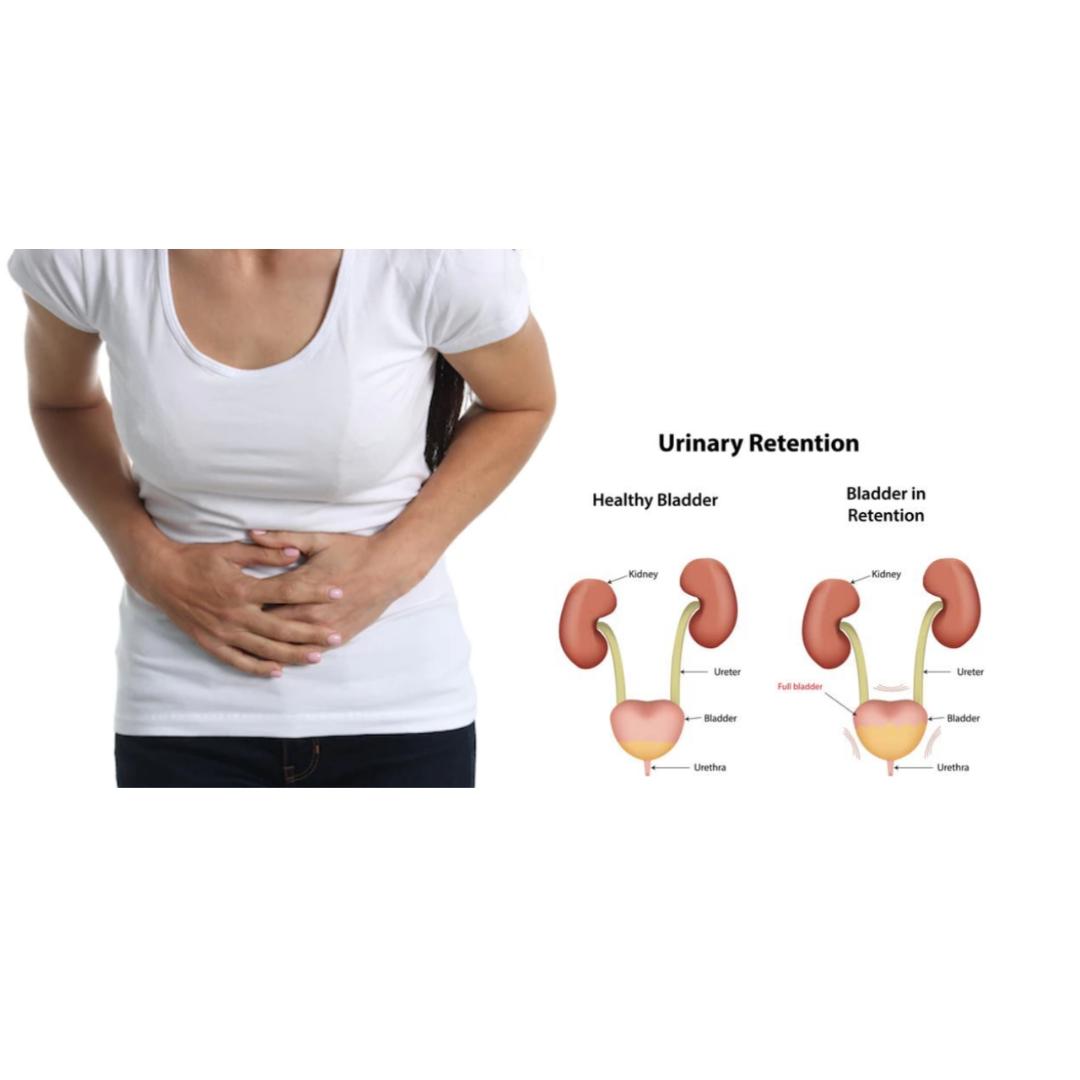 What Medications Cause Urinary Retention