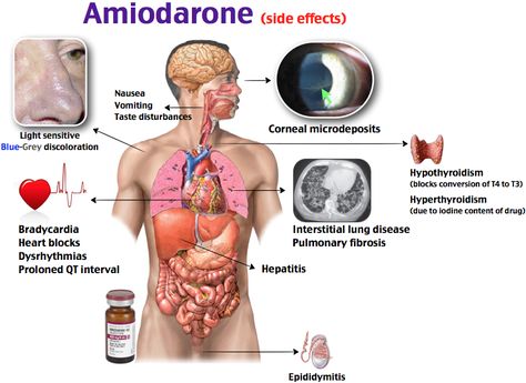 amiodarone side effects