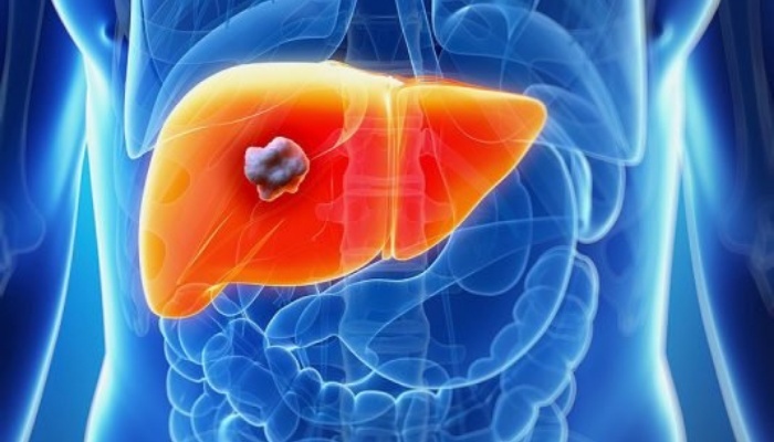 HLB's Liver Cancer Drug Gets FDA’s Orphan Drug Status