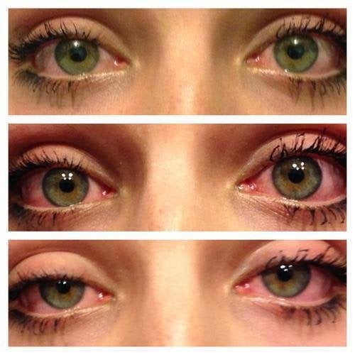 Stoned eyes