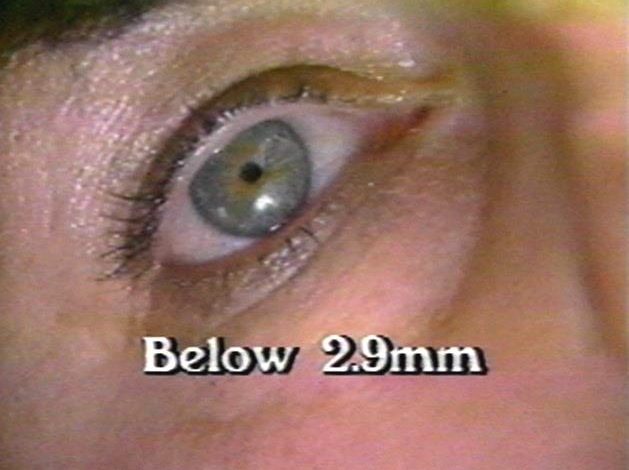What Drugs Cause Pinpoint Pupils