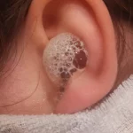Can you put hydrogen peroxide in your ear2