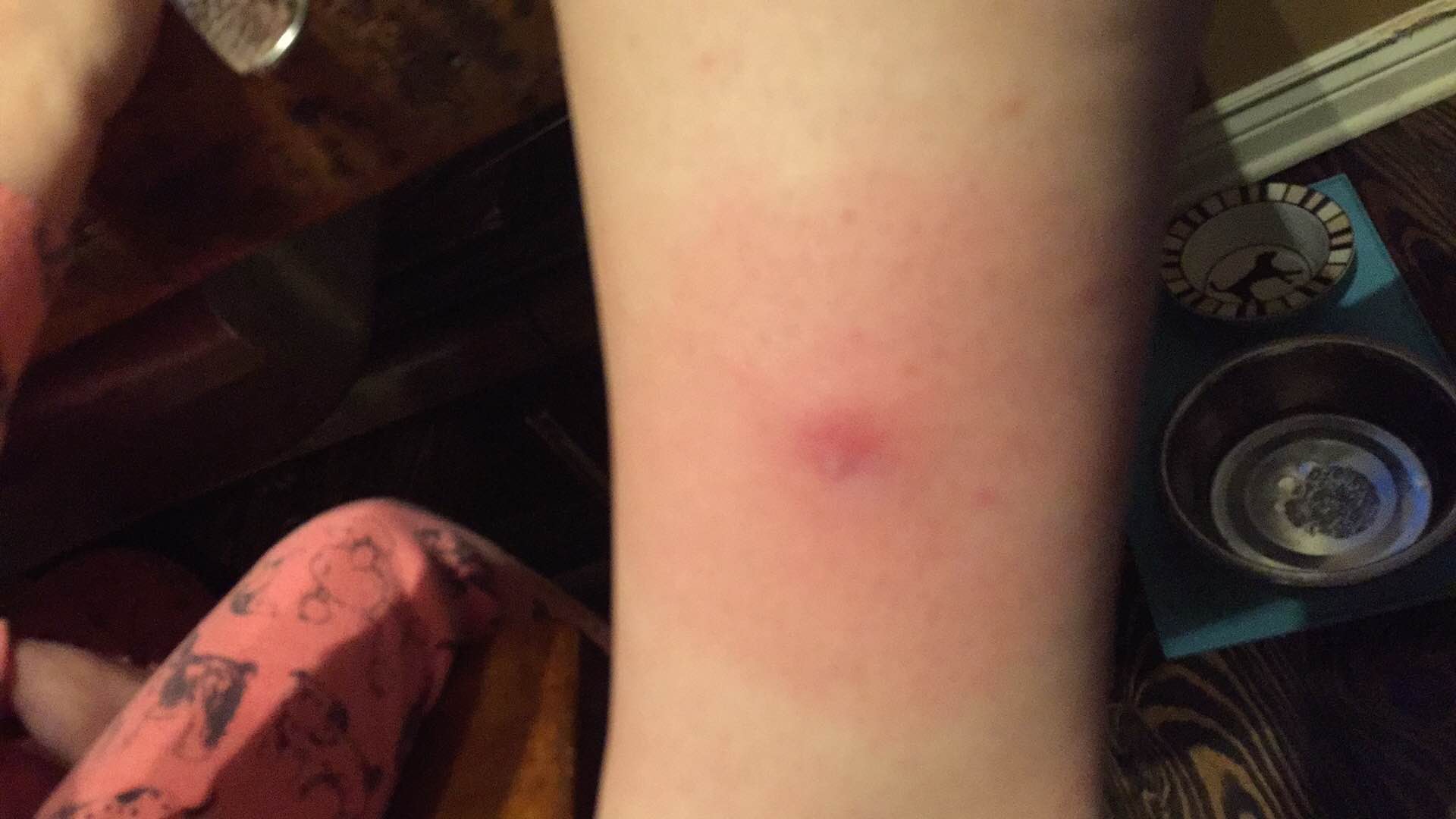 Doxycycline for MRSA