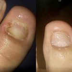 Vicks Vaporub Rub On Feet Dangers