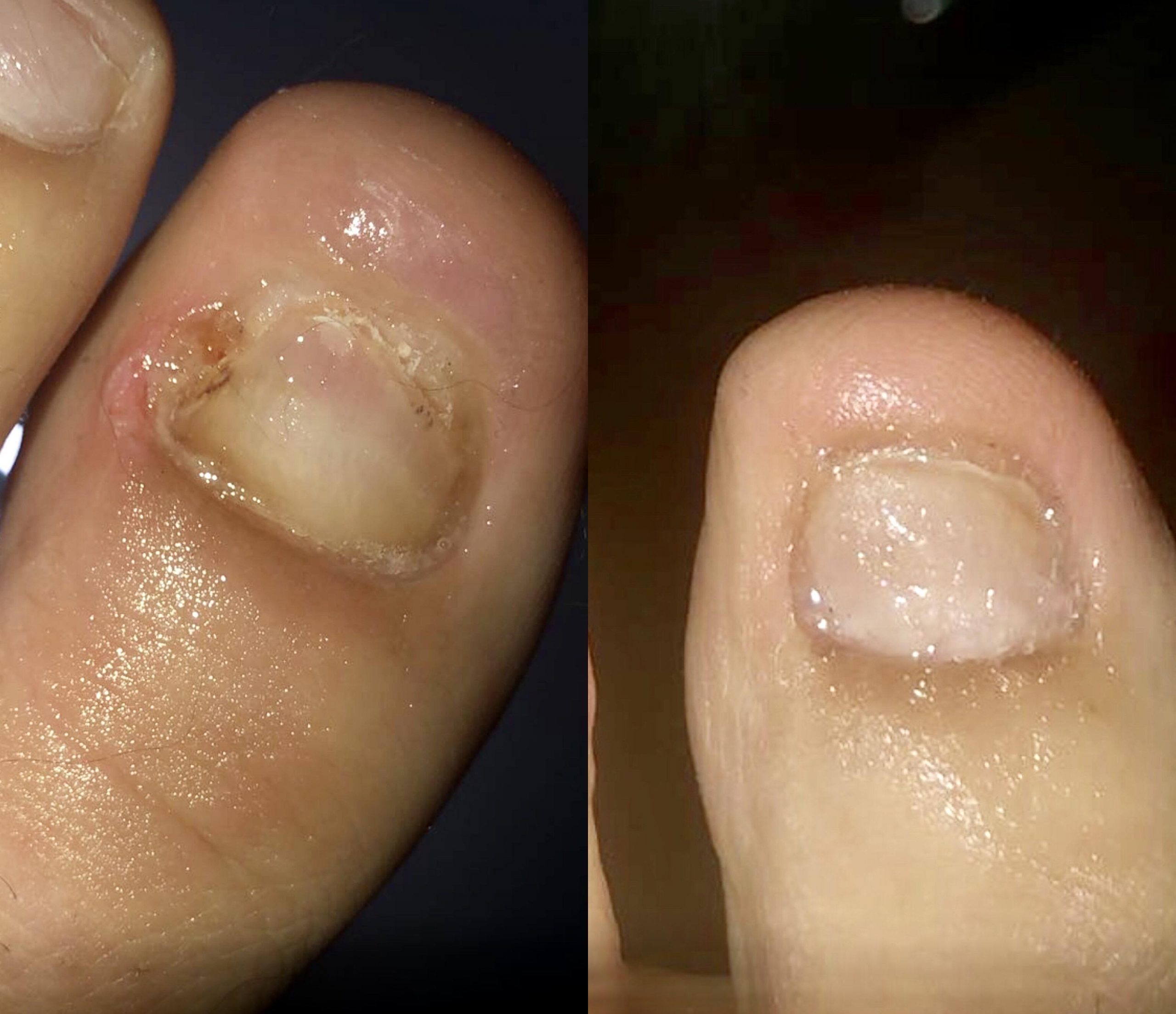 Dangers Of Using Vicks VapoRub On Your Feets Meds Safety