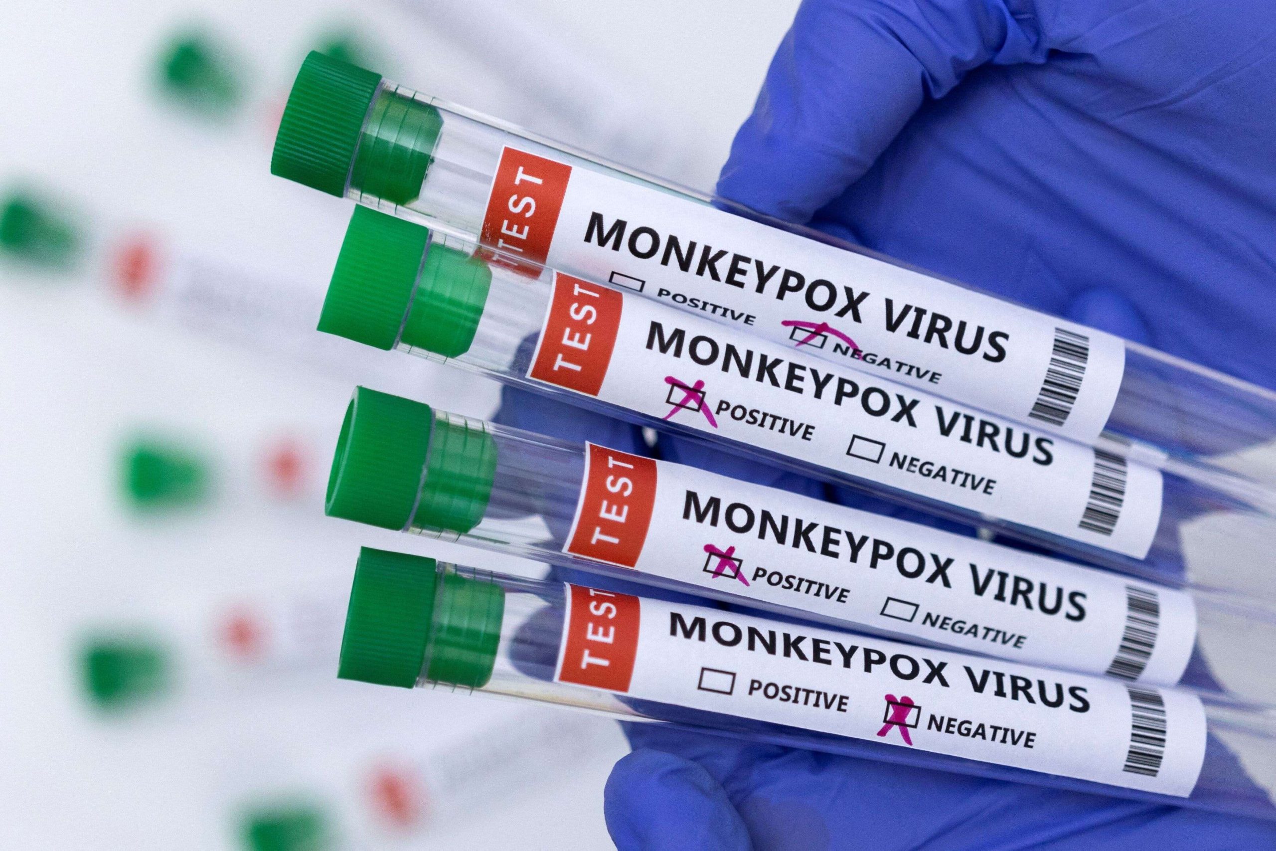 US Responds To Monkeypox Outbreak With 296k Vaccines scaled