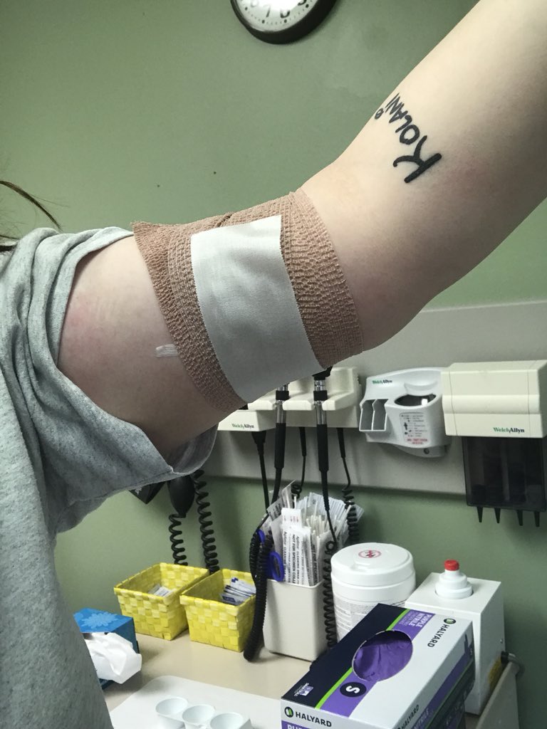 Weight Loss After Nexplanon Removal