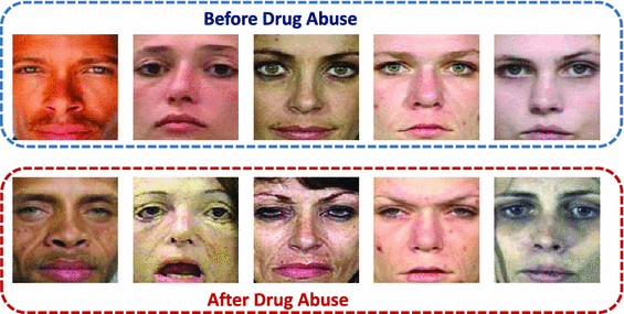 Before and After Photos Of Drug Abuse