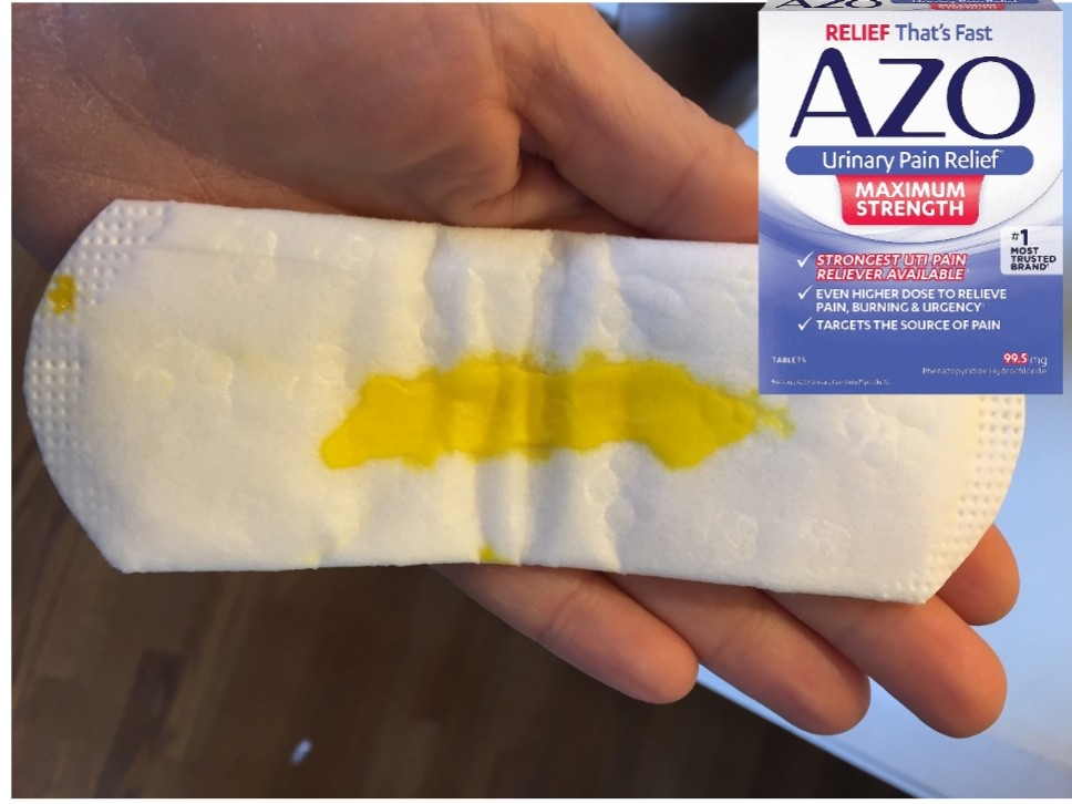 is-yellow-discharge-after-taking-azo-urinary-pain-relief-normal-meds