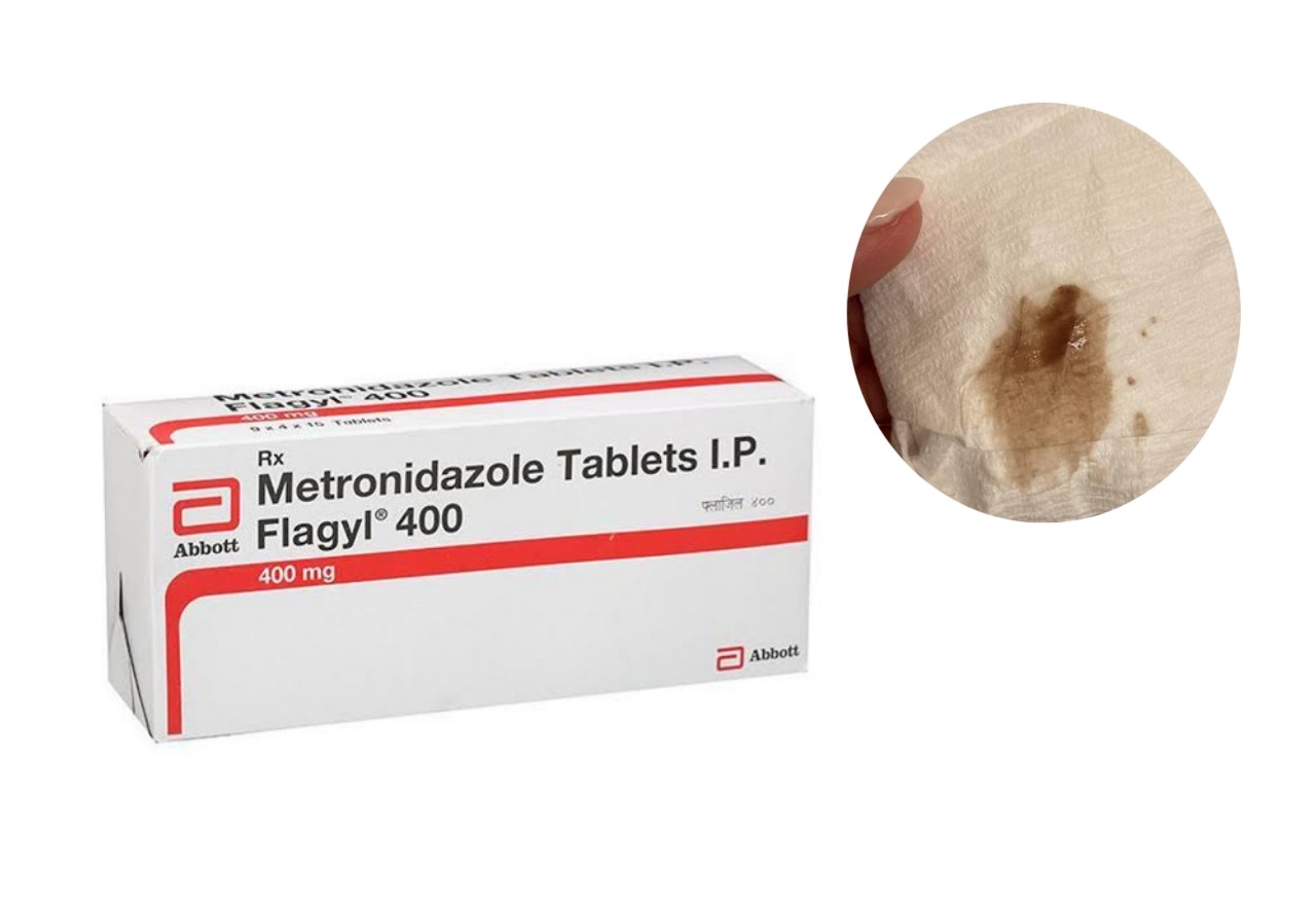 rown Discharge After Taking Metronidazole