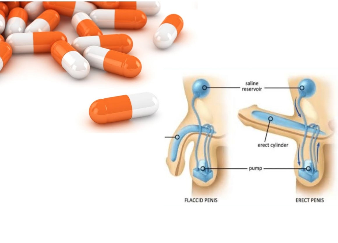 Can Adderall Cause Permanent Erectile Dysfunction