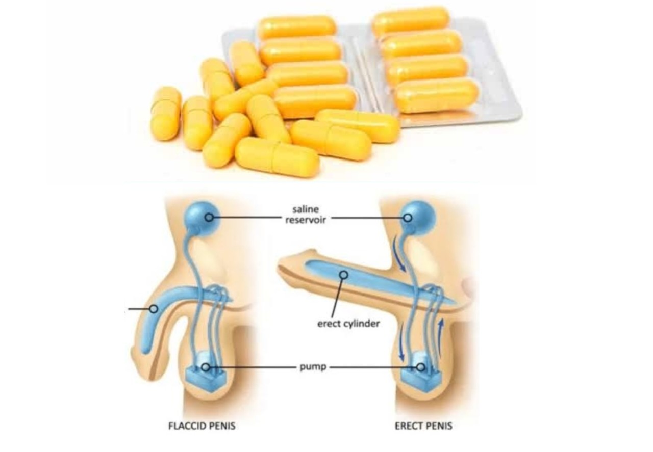 Gabapentin Erectile Dysfunction Permanent