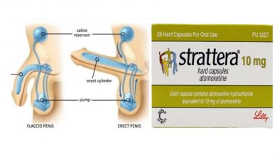 Strattera Erectile Dysfunction Permanent