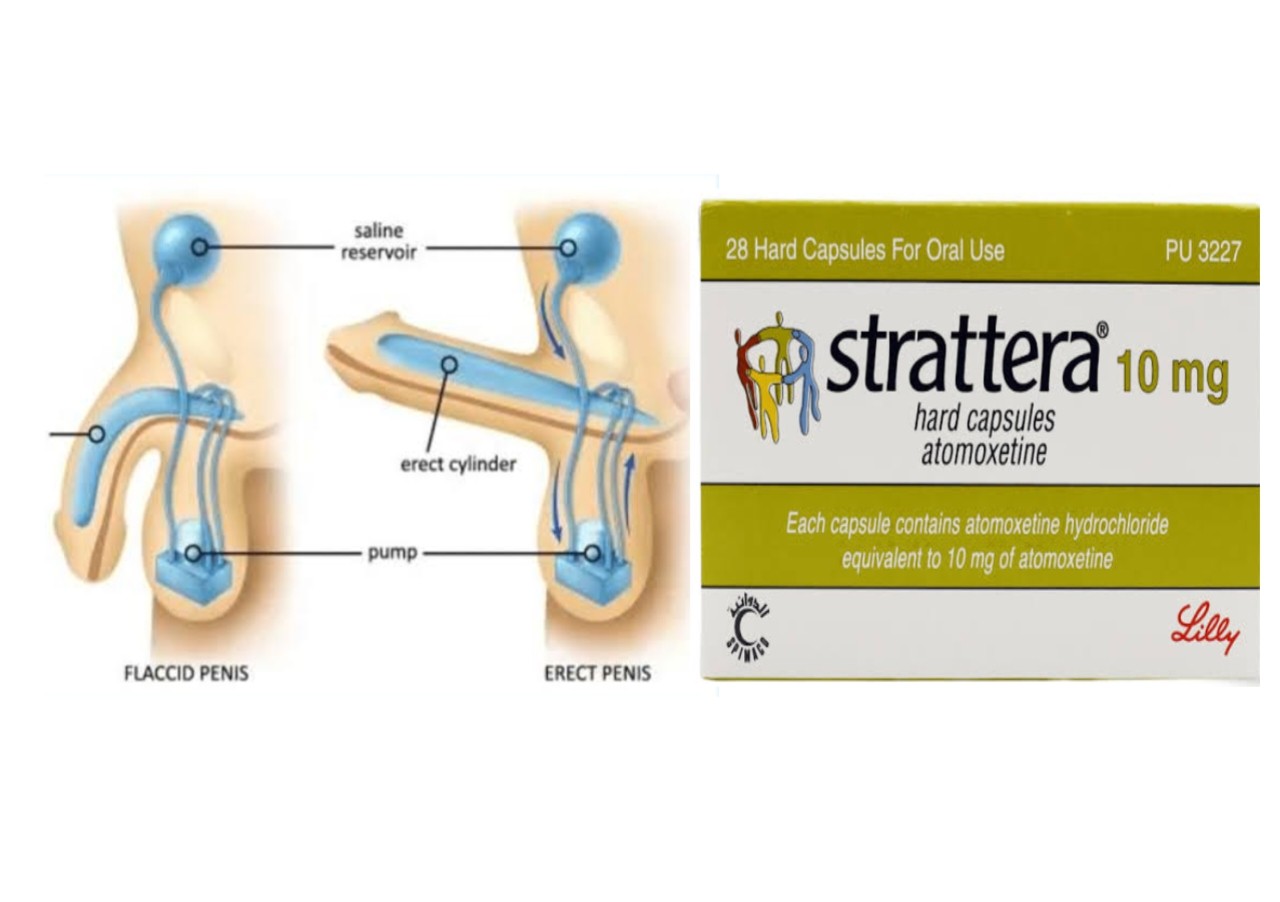 Is Strattera Erectile Dysfunction Permanent Meds Safety