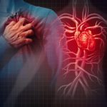 Bempedoic Acid Cuts Cardiovascular Events In Statin Intolerant Patients