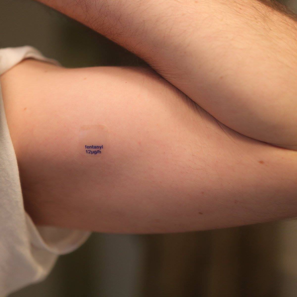 Do Expired Fentanyl Patches Work