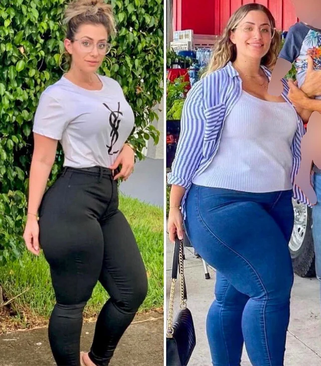 Does Tramadol Cause Weight Gain