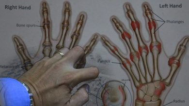 What Is The Safest Drug For Rheumatoid Arthritis