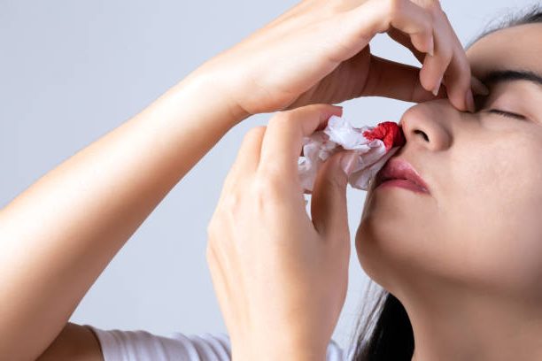 Does Vyvanse Cause Nose Bleeds