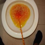 Drugs That Change Urine Color