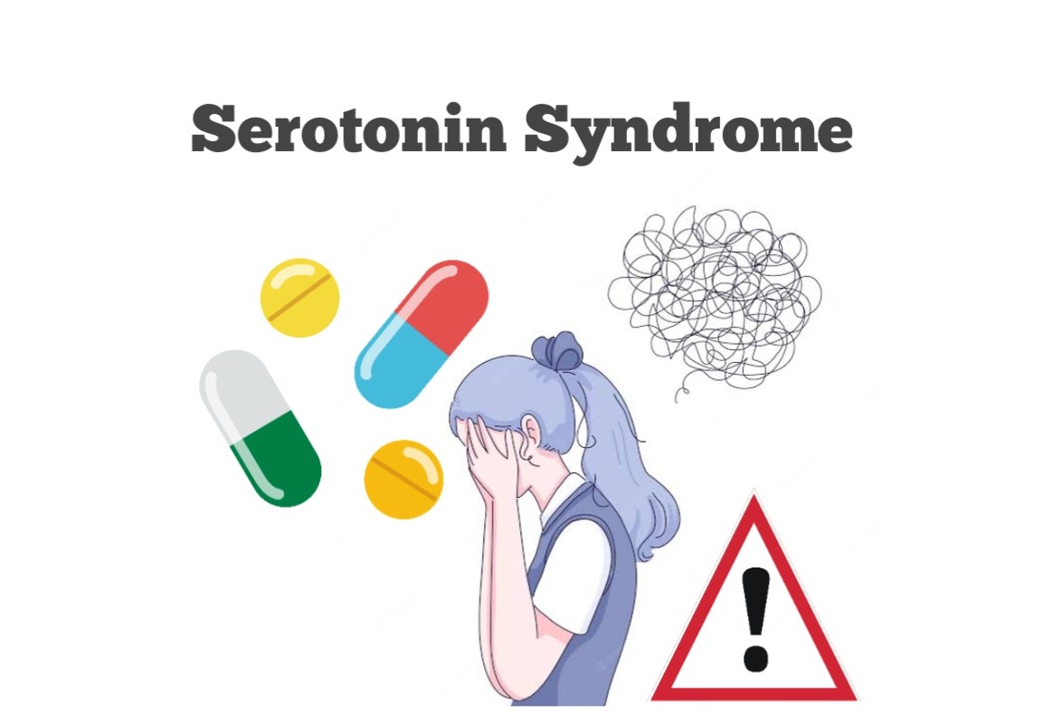 Serotonin Syndrome