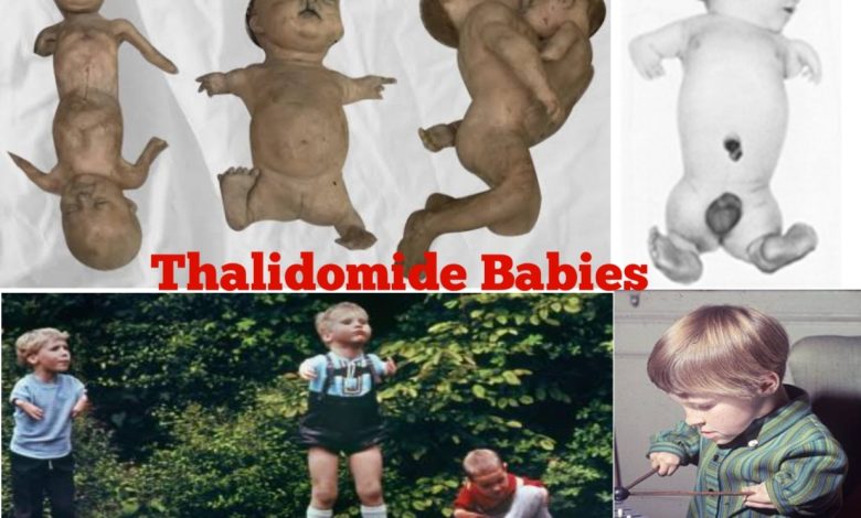 Thalidomide Babies