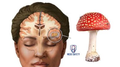 How Psilocybin in Magic Mushroom Help With Migraines