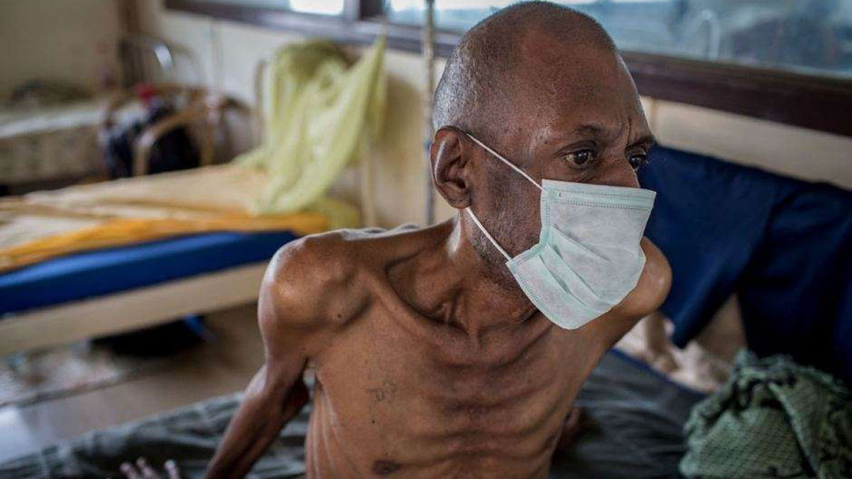 Johnson & Johnson Slashes Price of TB Drug in Low Income Countries to Expand Access