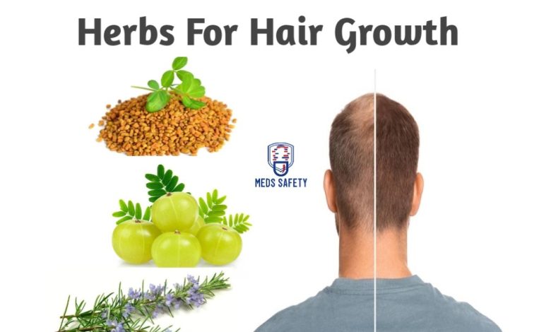 List of 10 Best Herbs for Hair Growth