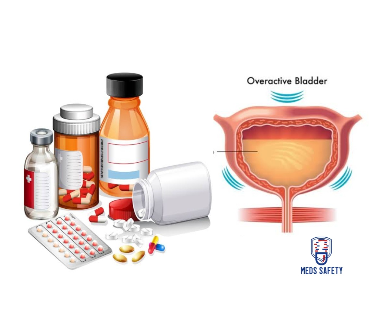 Medications to Avoid When Living With Overactive Bladder (OAB) - Meds ...