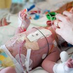 Newborns Need Methadone Post Surgery